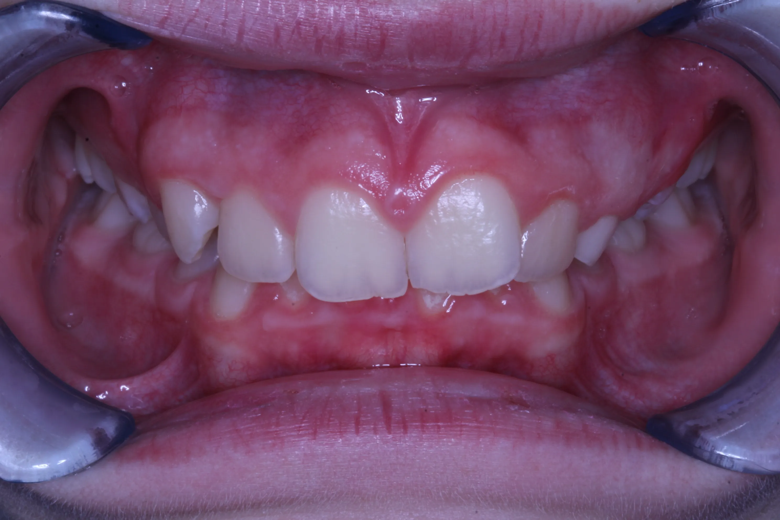 smile-gallery gallery